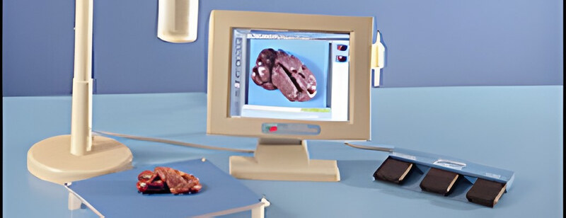 The MacroPATH digital imaging system, with its camera stand, a specimen and a monitor showing the specimen