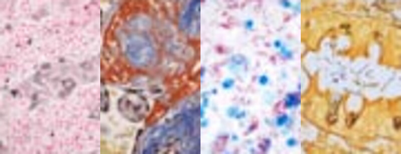 Four stained cell and tissue samples side by side, from the UK NEQAS for Cellular Pathology Technique website in 2007